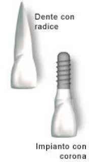 Impianti